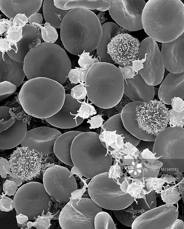 红细胞、T淋巴细胞和活化血小板，扫描电镜图片素材