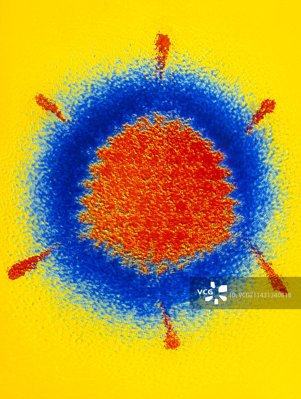 腺病毒的伪彩色透射电镜图像图片素材