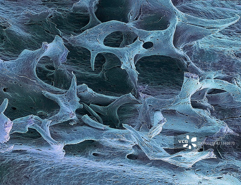 骨质疏松的松质骨扫描电镜图图片素材