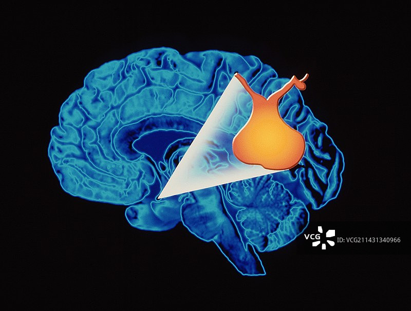 定位脑垂体的电脑艺术作品图片素材