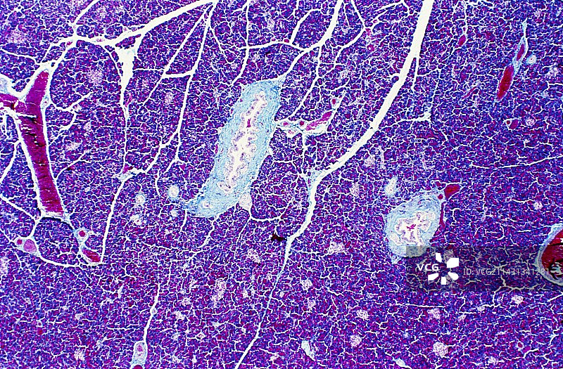 胰腺光学显微照片图片素材