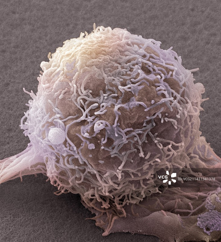 皮肤癌细胞，扫描电子显微镜图片素材