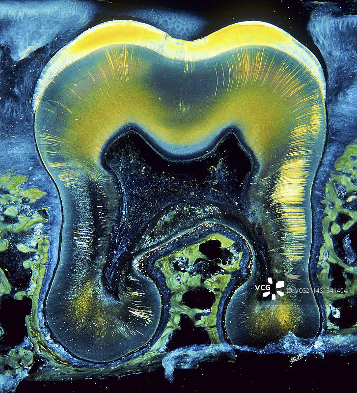 人类牙齿，光学显微照片图片素材