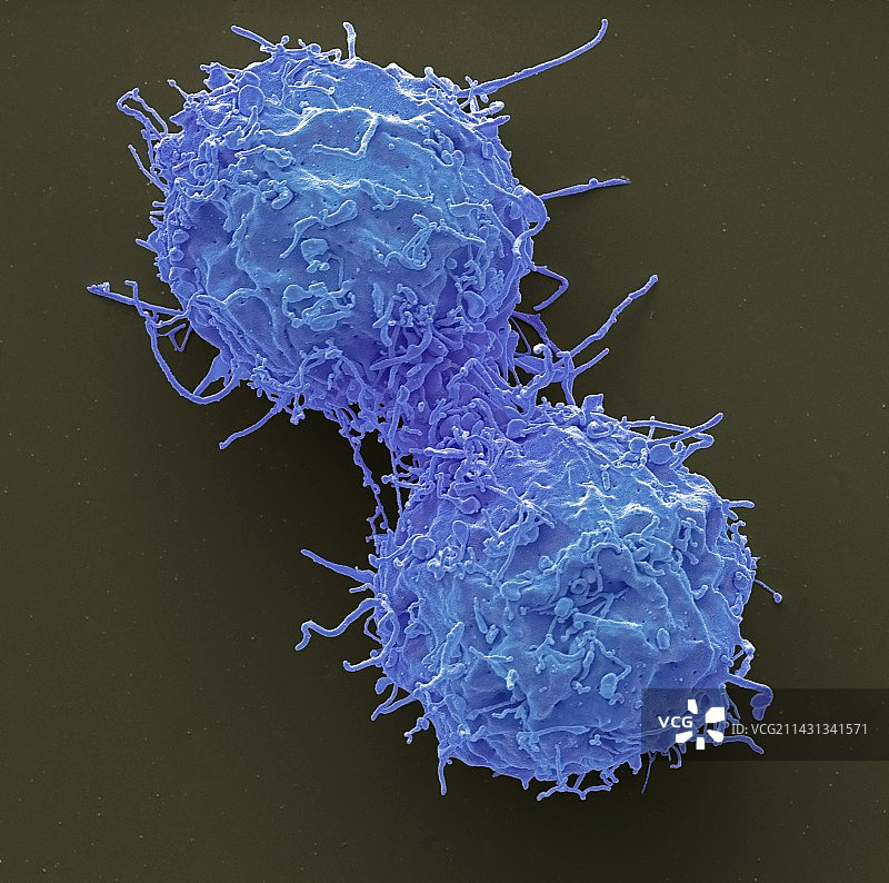 白血病细胞分裂，扫描电镜图片素材