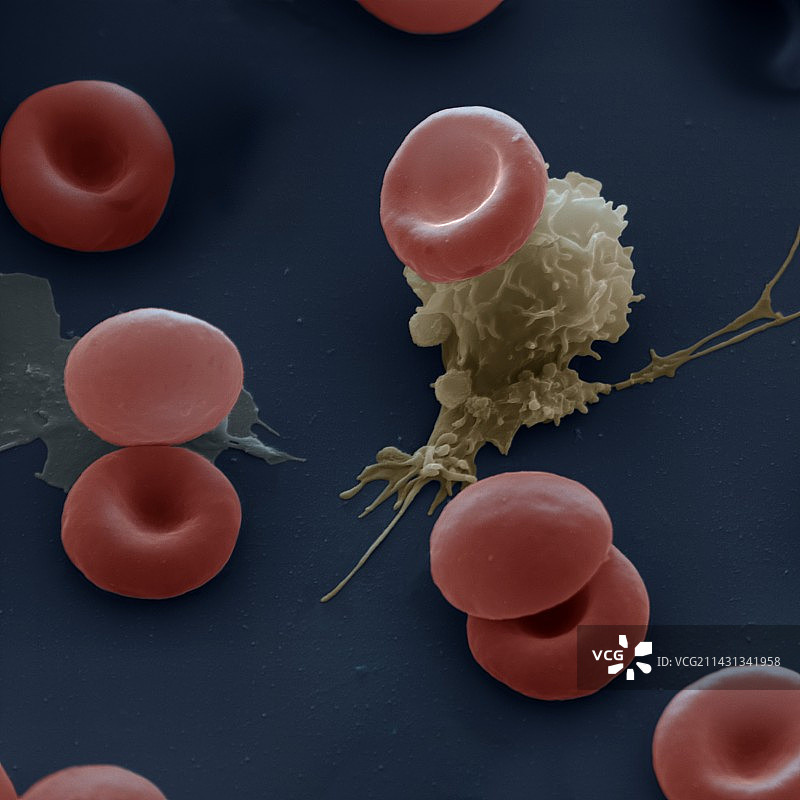 血细胞扫描电镜图图片素材