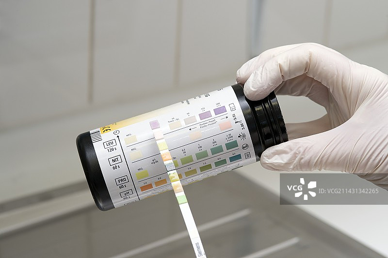 尿液检查图片素材