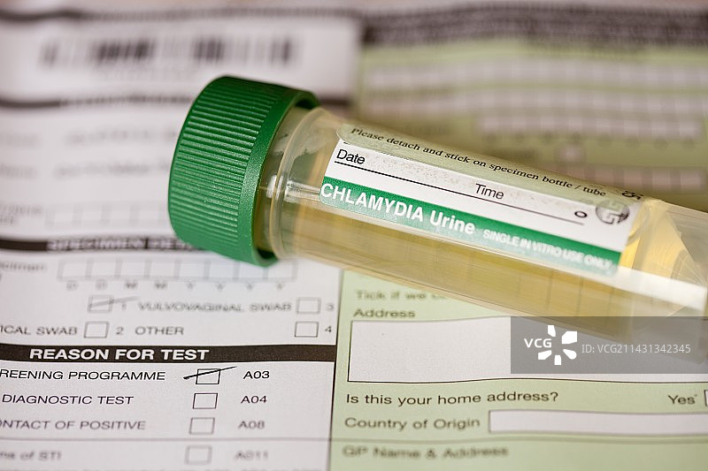 用于自检的衣原体试剂盒图片素材