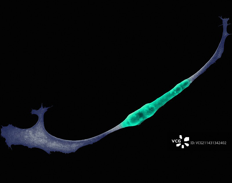 培养皿中的骨骼肌细胞扫描电镜图图片素材
