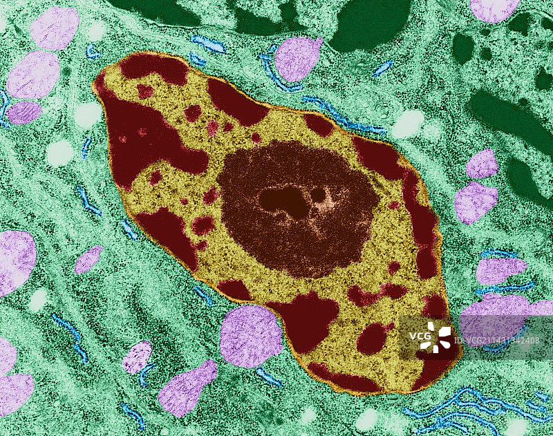 神经胶质细胞核，透射电镜图片素材