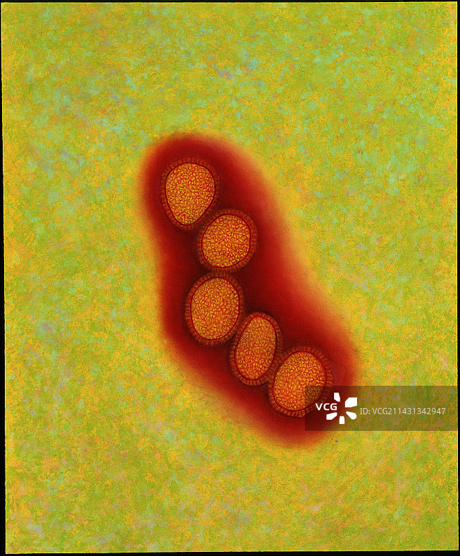 流感病毒簇的彩色透射电镜图像图片素材