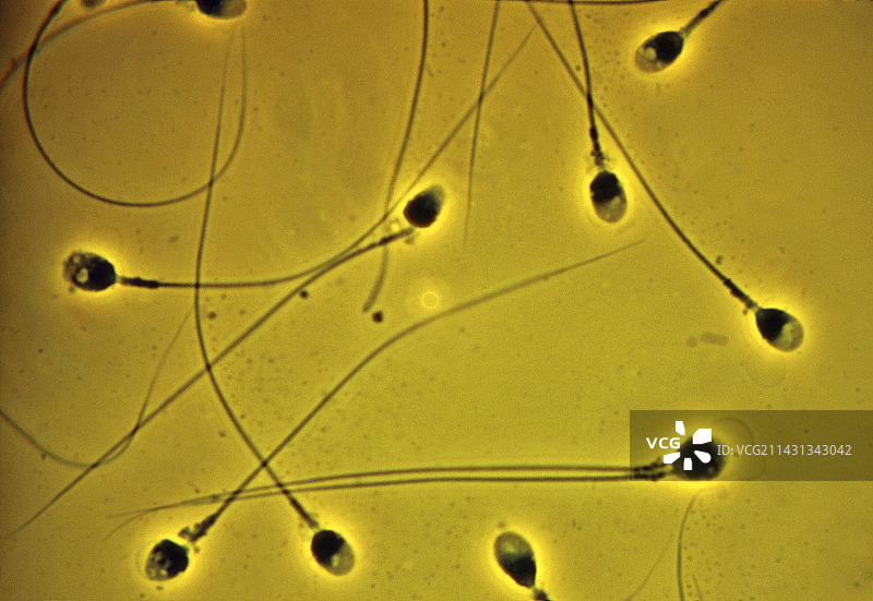显示具有两条尾巴的人类精子的LM显微照片图片素材