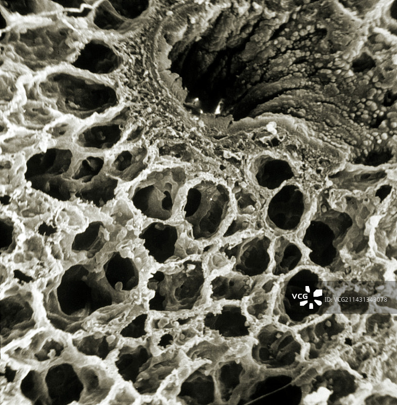 人肺切片的扫描电镜图图片素材