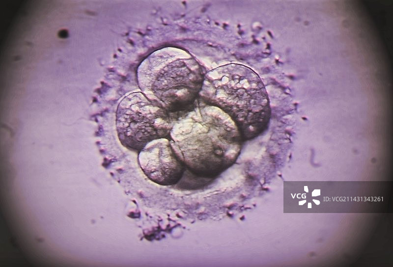 试管婴儿胚胎显微照片图片素材