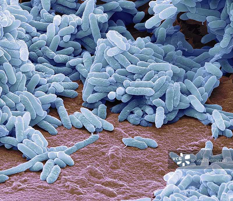 水螺旋菌（扫描电镜图）图片素材