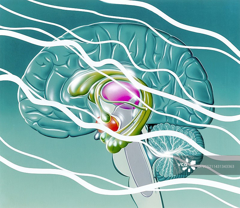 癫痫病中的大脑图片素材