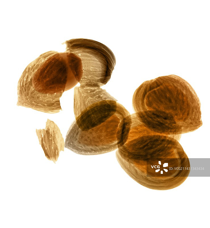 杏仁X光片图片素材