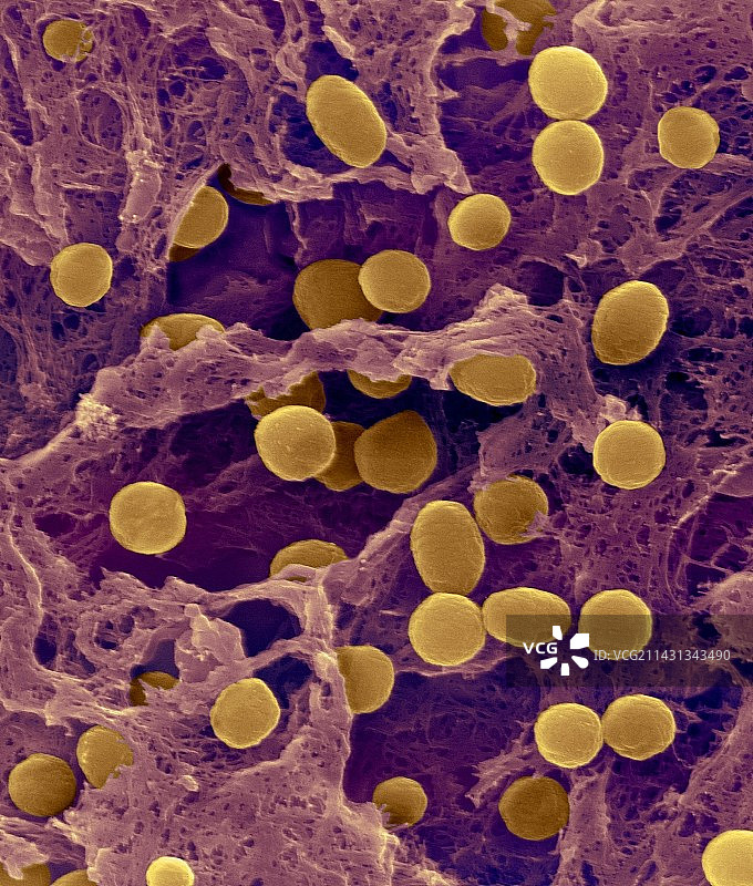 Acidobacterium sp.土壤原核生物,扫描电子显微镜图片素材