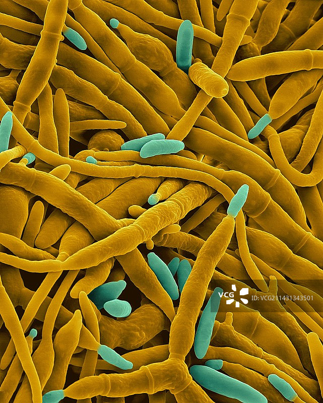 有毒真菌（串珠镰刀菌），扫描电子显微镜图片素材