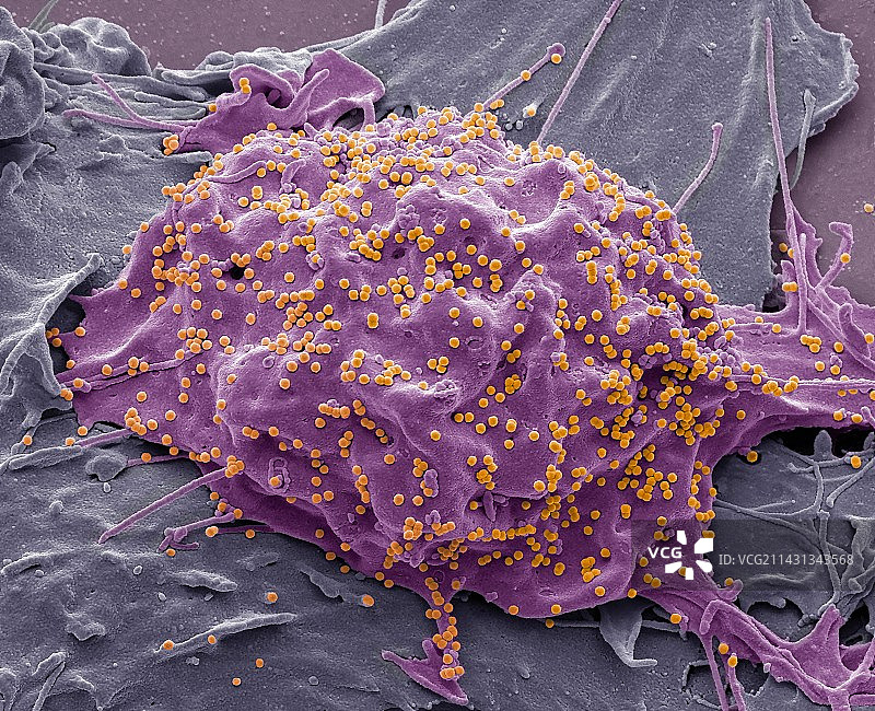 SIV感染细胞,SEM图片素材