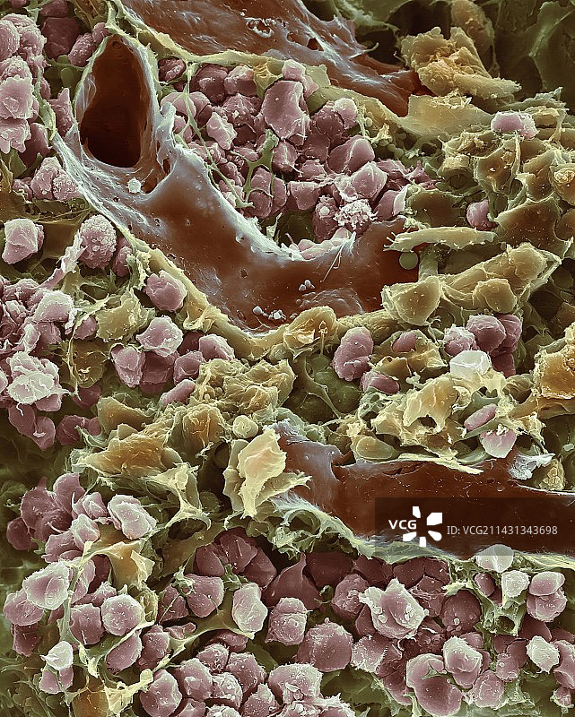 骨髓扫描电镜图图片素材