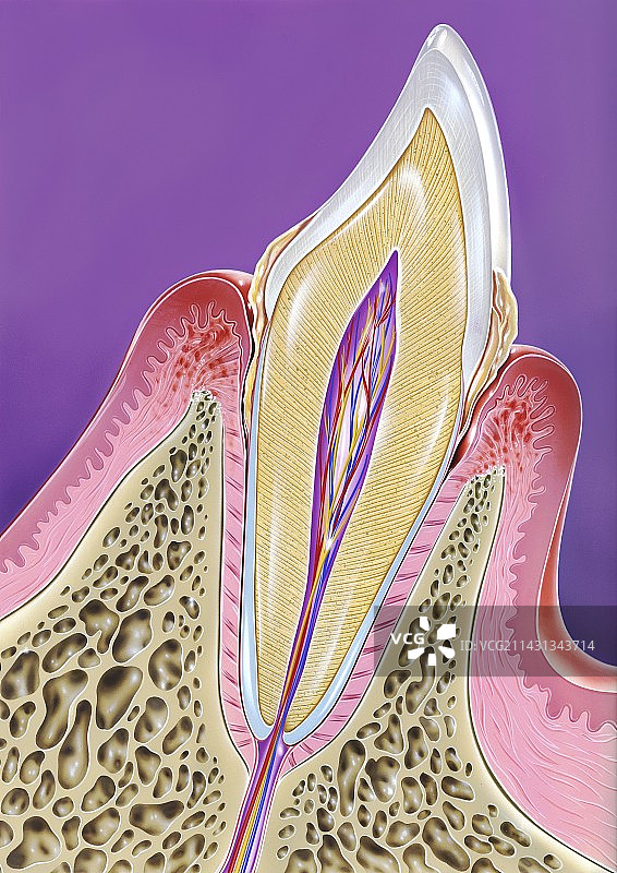 牙周疾病插图图片素材