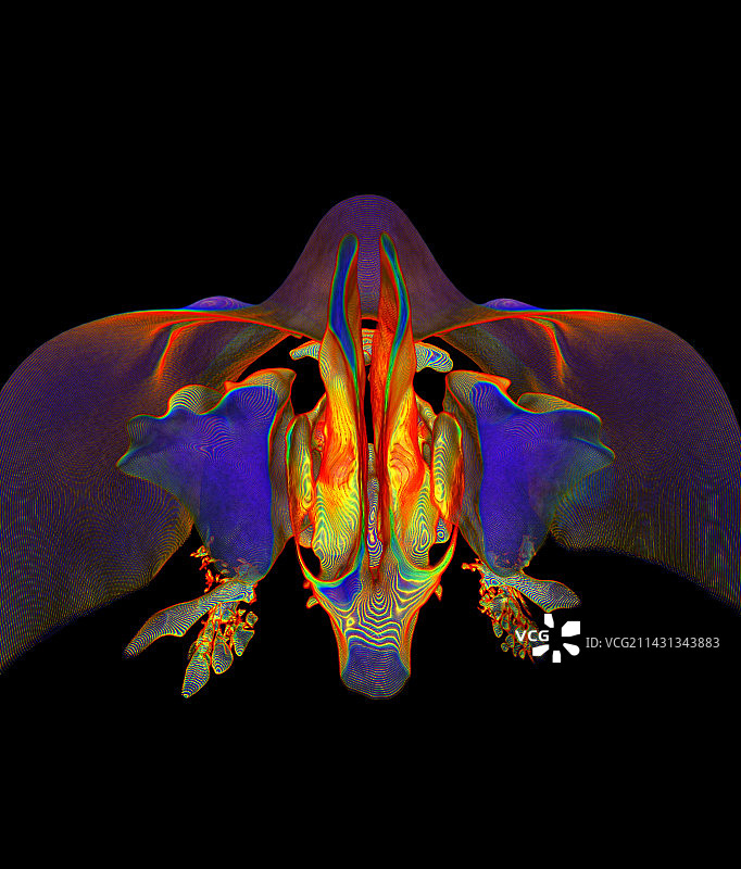 鼻腔和鼻窦的3D CT扫描图片素材