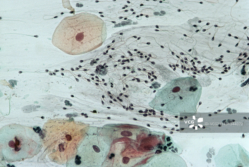 含有精子的宫颈涂片图片素材
