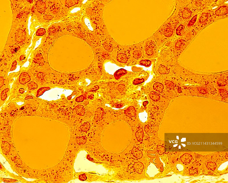 甲状腺滤泡显微照片图片素材