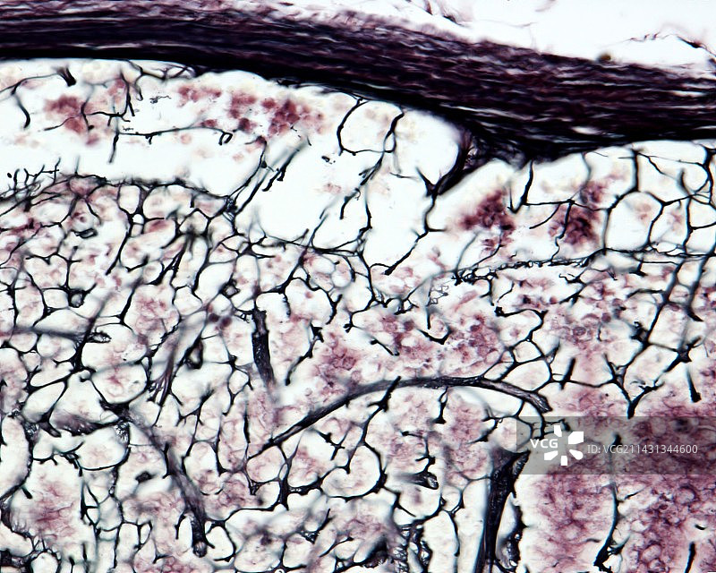 淋巴结网状纤维（光学显微照片）图片素材