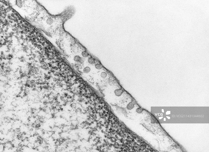 毛细血管内皮细胞的胞吞作用，透射电镜图片素材