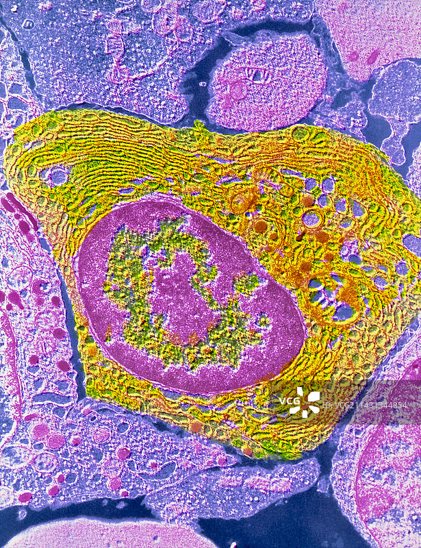 人浆细胞的伪彩色透射电镜图图片素材