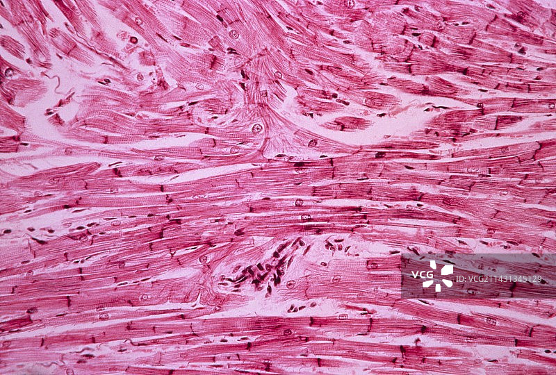 心肌，光学显微照片图片素材