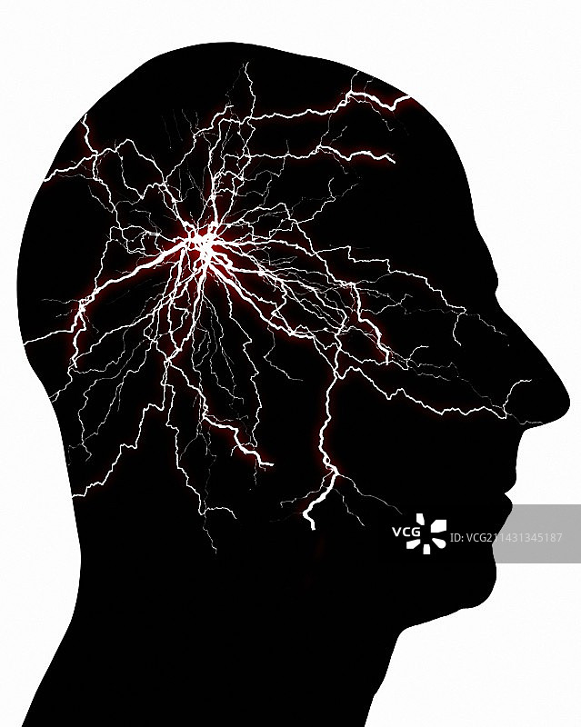 偏头痛概念图图片素材