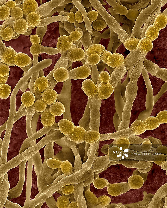 霉菌（枝孢菌属）菌丝和孢子，扫描电镜图片素材