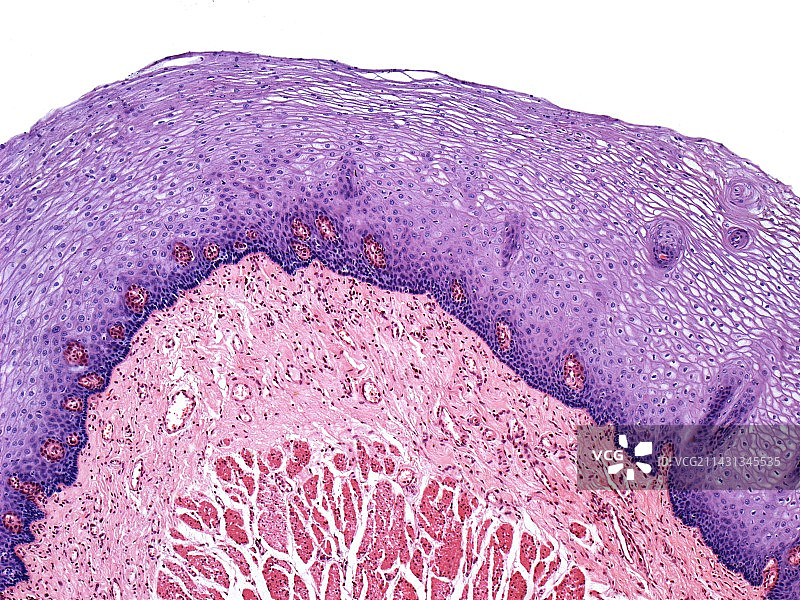 食道光显微照片图片素材