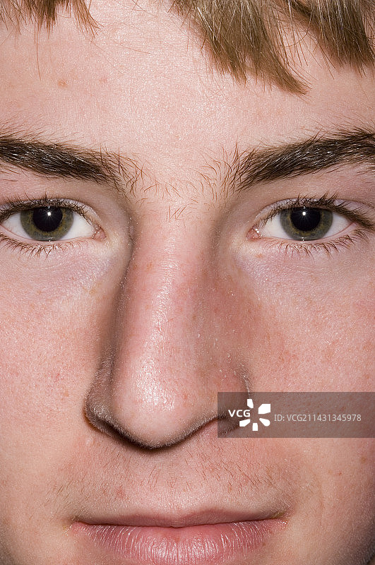 受伤的鼻子图片素材