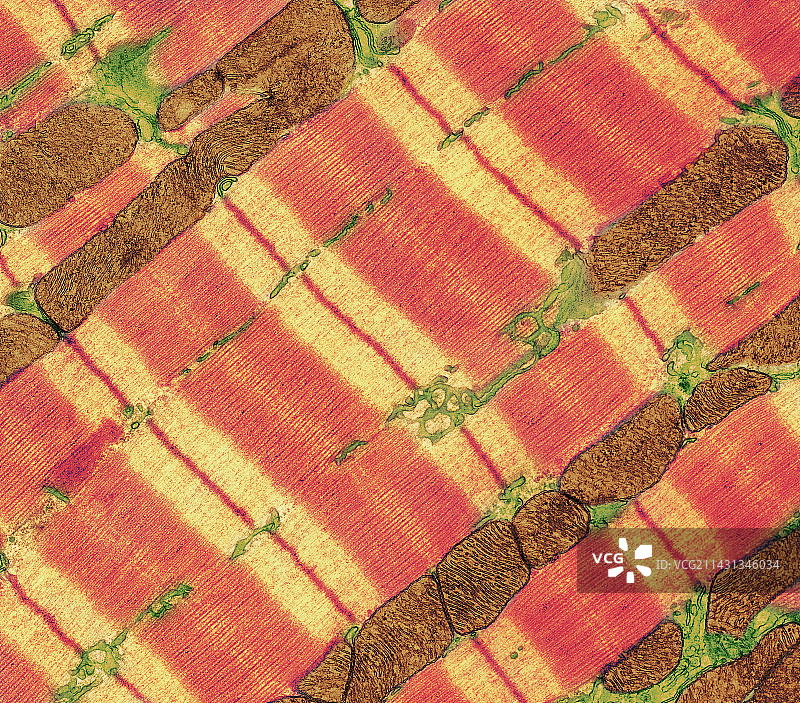 心肌组织TEM图片素材