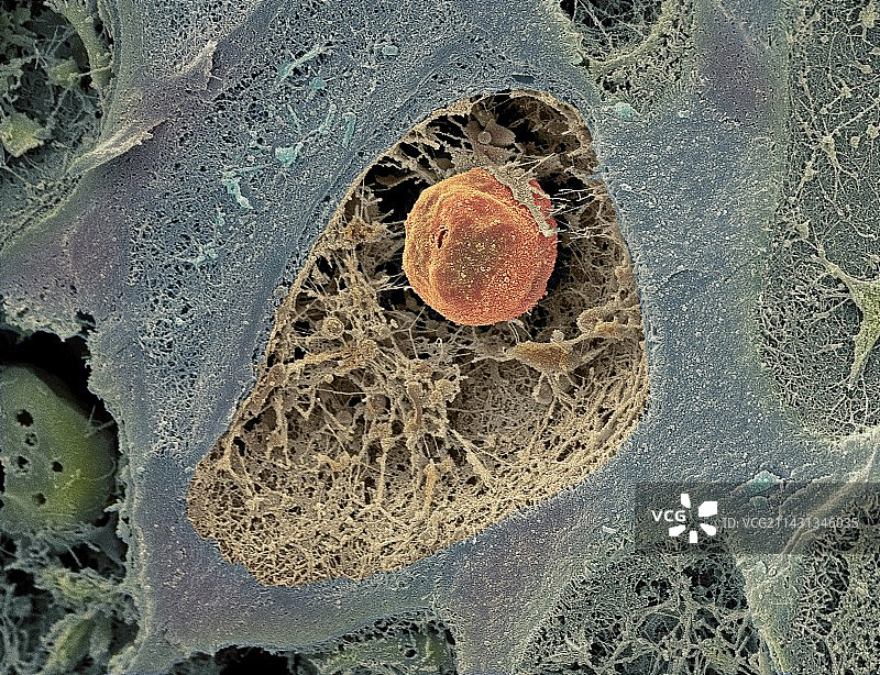 软骨细胞扫描电镜图图片素材