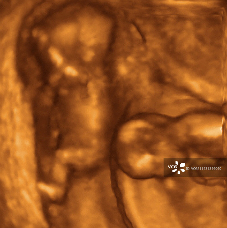 16周双胞胎3D超声波扫描图片素材