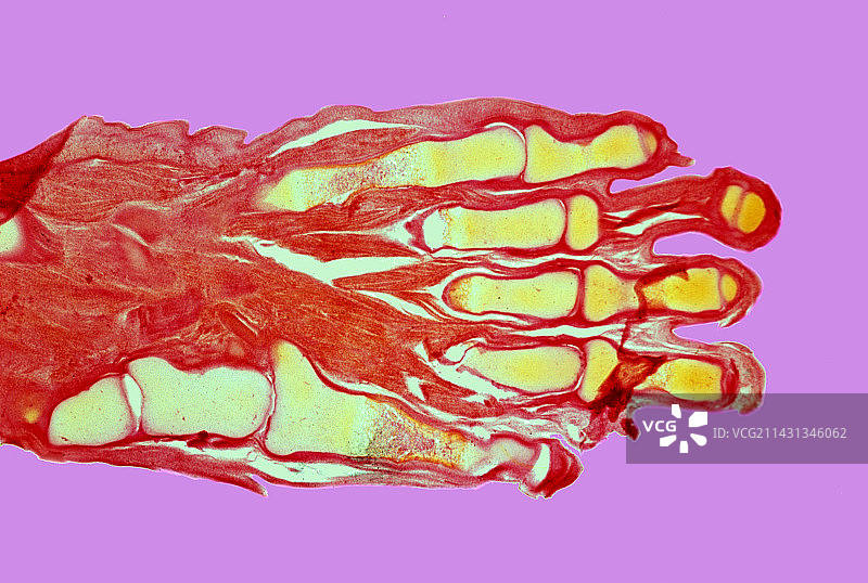 人类胎儿的手显微照片图片素材