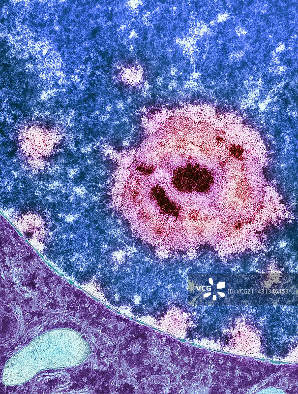 细胞核仁TEM图片素材