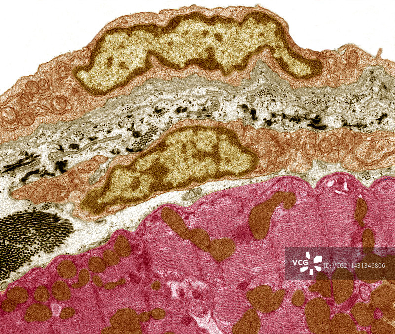 心包膜透射电镜图图片素材