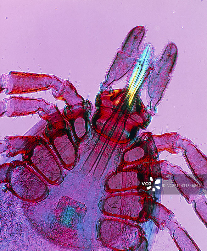 莱姆病蜱虫图片素材