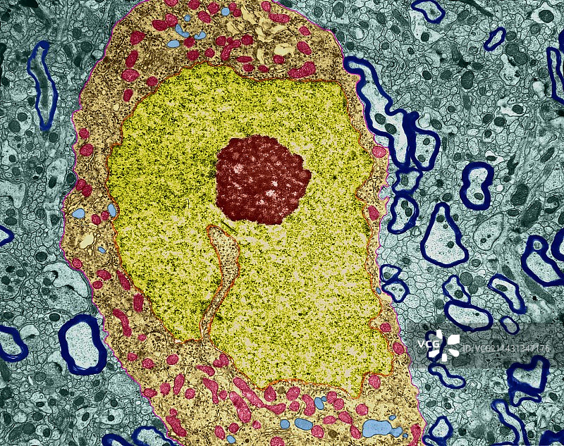 神经元大细胞核和核仁，TEM显微图图片素材