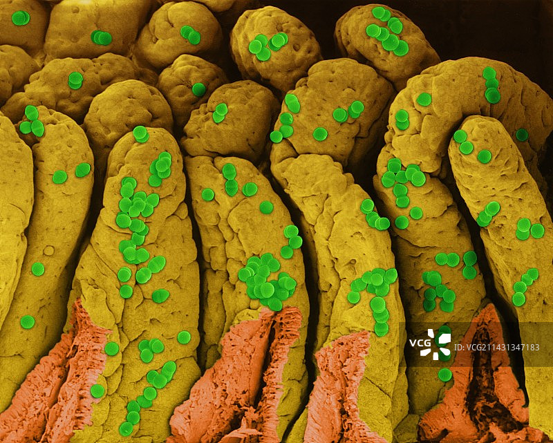 小肠上的屎肠球菌，扫描电镜图片素材