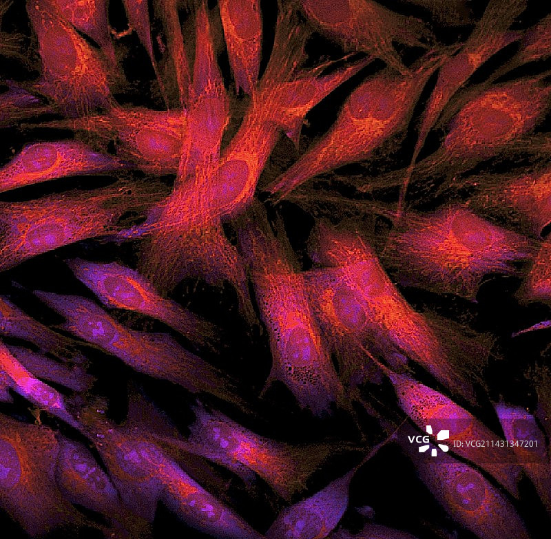 成纤维细胞荧光显微照片图片素材