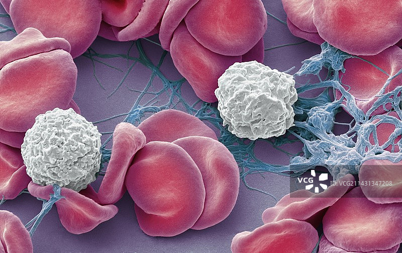 伤口部位的血液，SEM显微镜图像图片素材