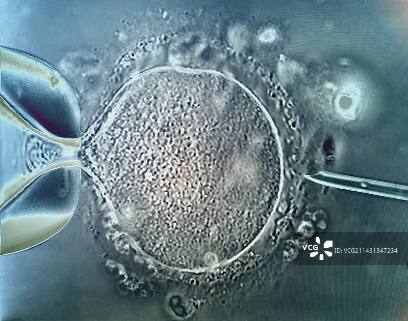体外受精显微照片图片素材