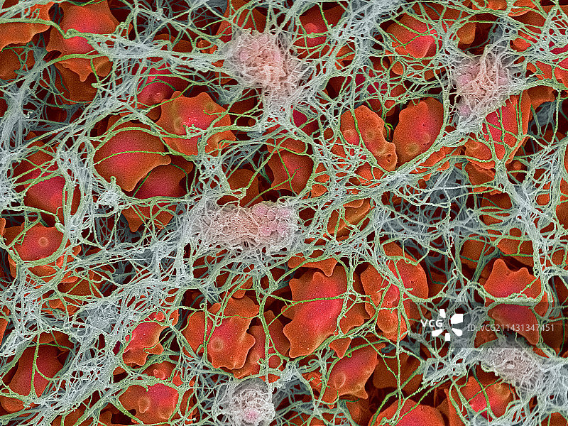 血栓扫描电镜图片素材