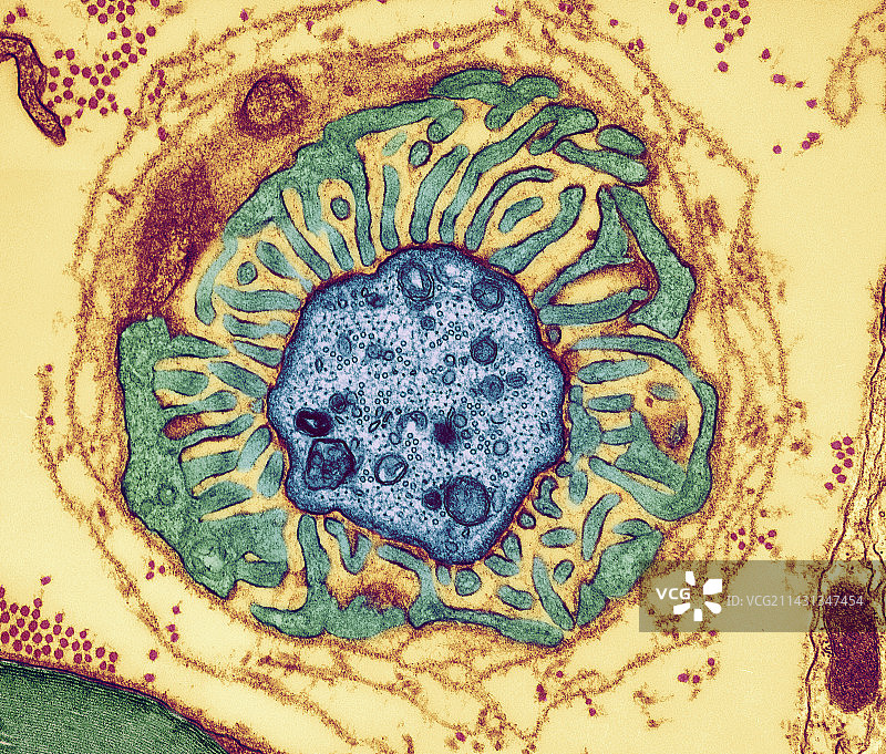 神经纤维结，TEM图片素材
